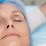 What is Blepharoplasty