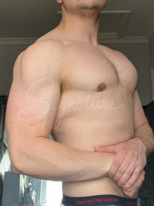 Gynecomastia-After2, cosmetic surgery, signature clinic