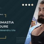 Former Mr Universe Receives Signature Gynecomastia Surgery