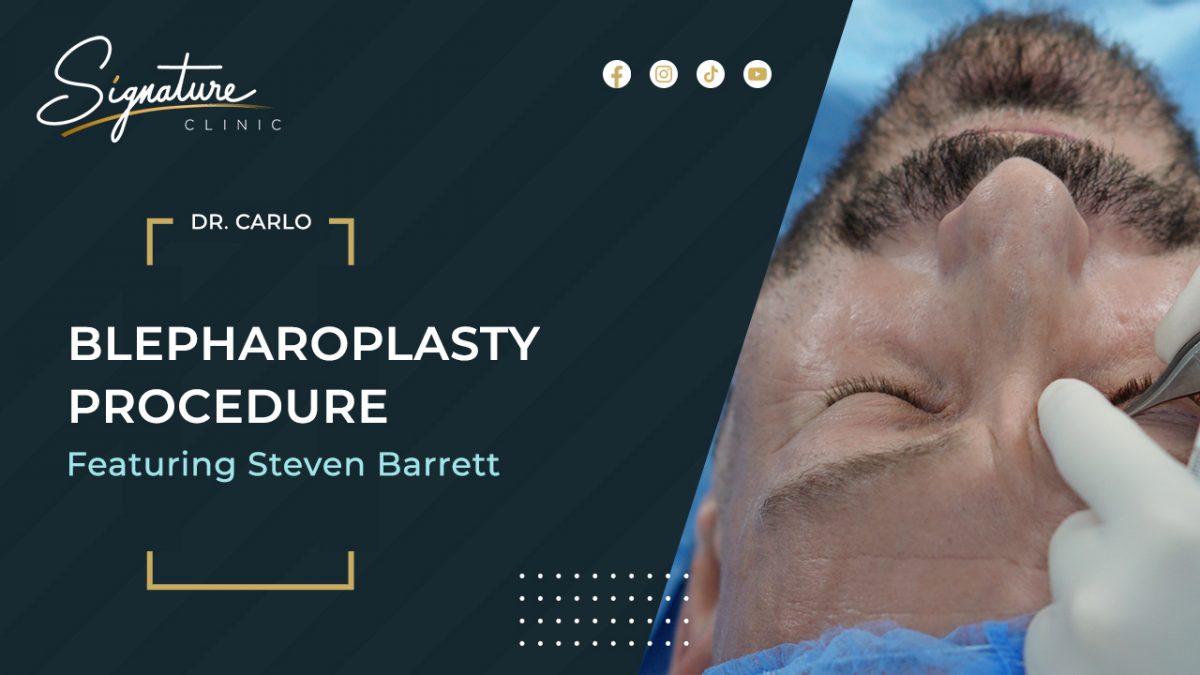 Fitness Influencer Undergoes Life Changing Cosmetic Surgery