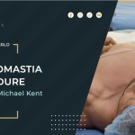 Unveiling Confidence: How UK Bodybuilding Champion Michael Kent Conquered Gynecomastia with Signature Clinic