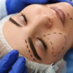 why-should-you-choose-cosmetic-surgery-over-non-surgical-treatments