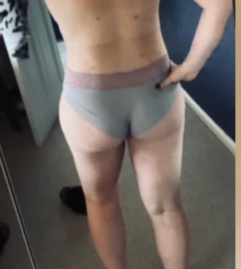 vaser liposuction after