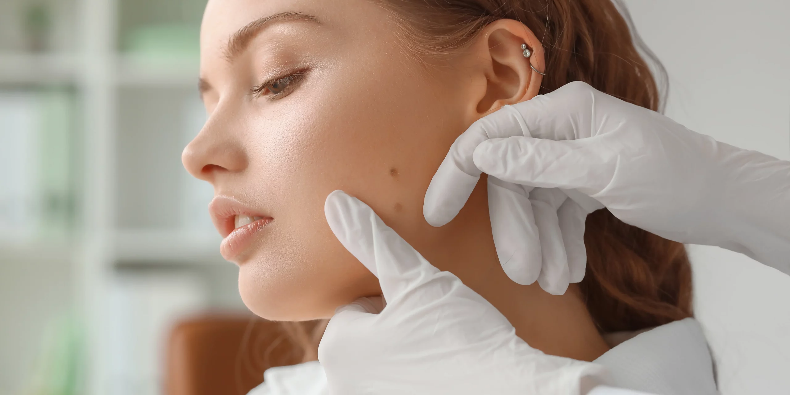 Mole removal