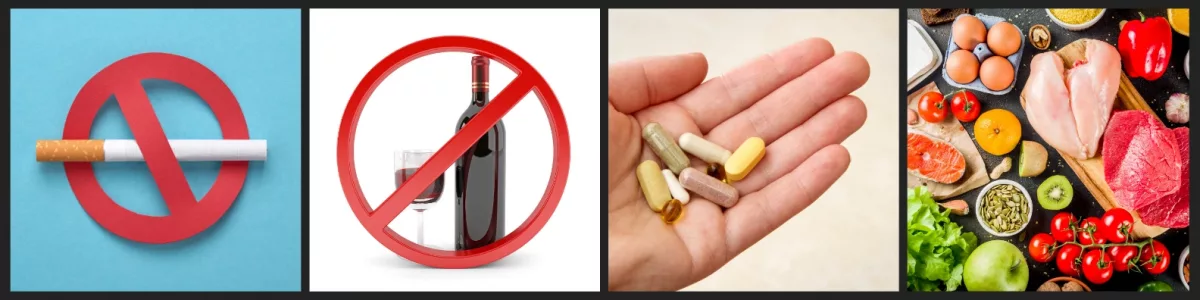 Preoperative Lifestyle Adjustments 