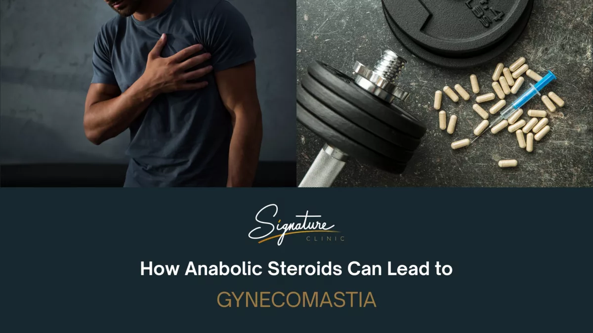How Anabolic Steroids Can Lead to Gynecomastia