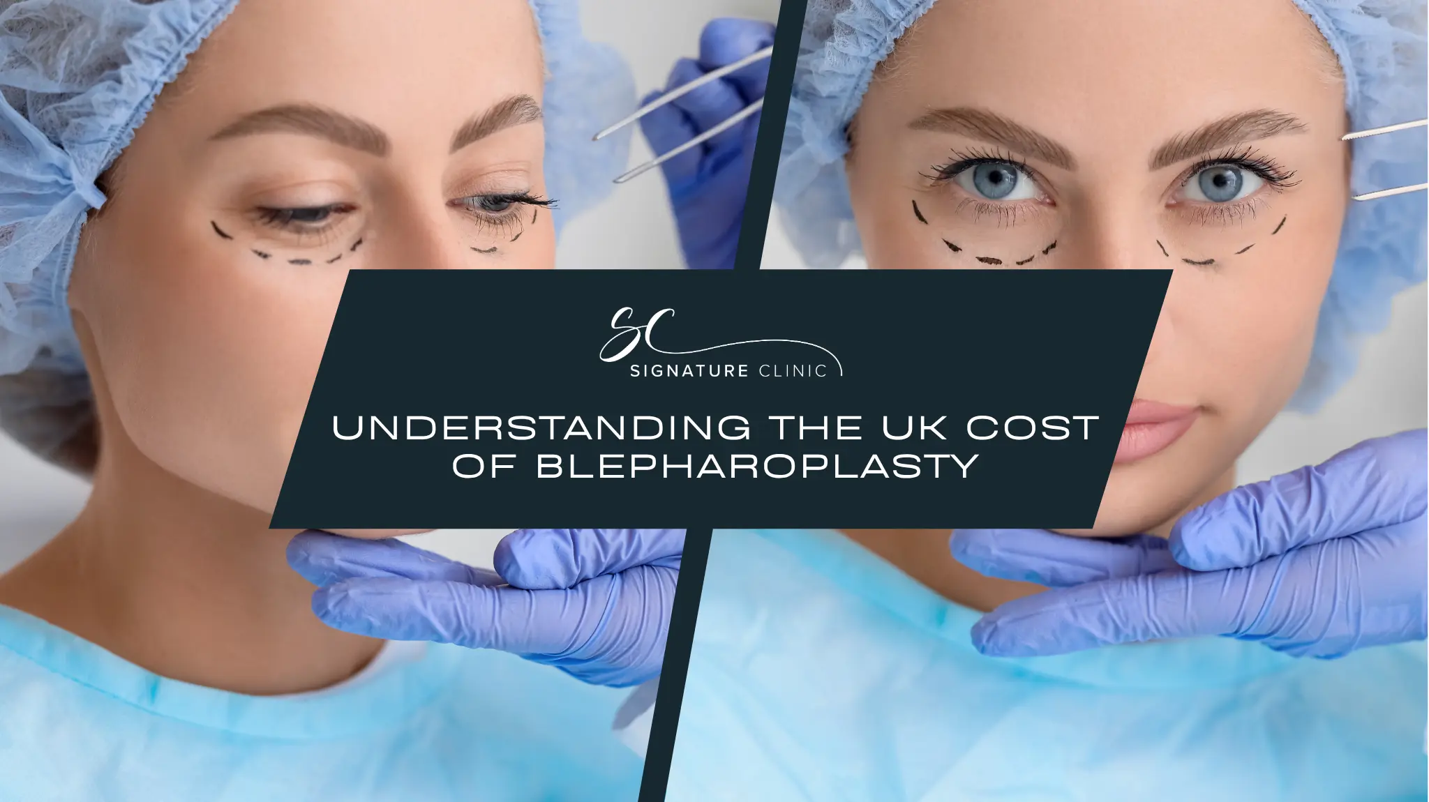UK Cost of Blepharoplasty