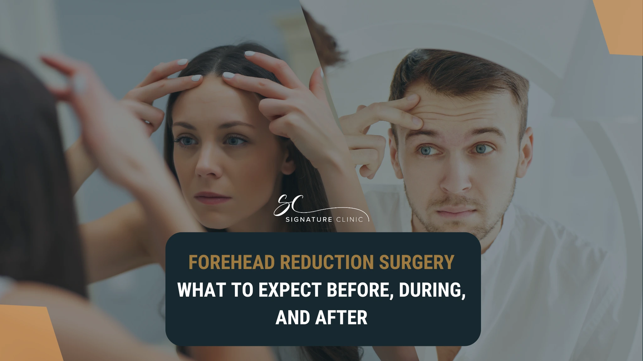 Forehead Reduction Surgery: What to Expect Before, During, and After