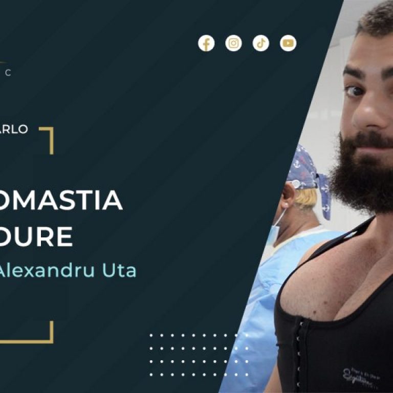Former Mr Universe Receives Signature Gynecomastia Surgery