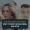 Forehead Reduction Surgery: What to Expect Before, During, and After