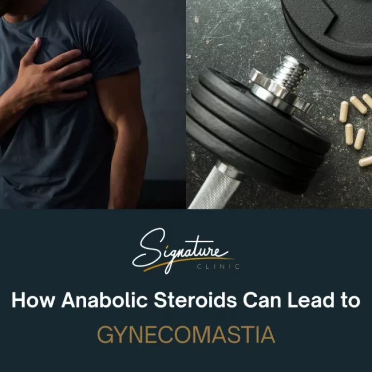 How Anabolic Steroids Can Lead to Gynecomastia