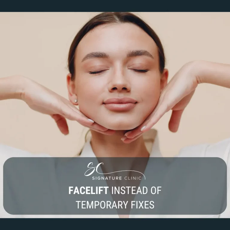 facelift over fillers