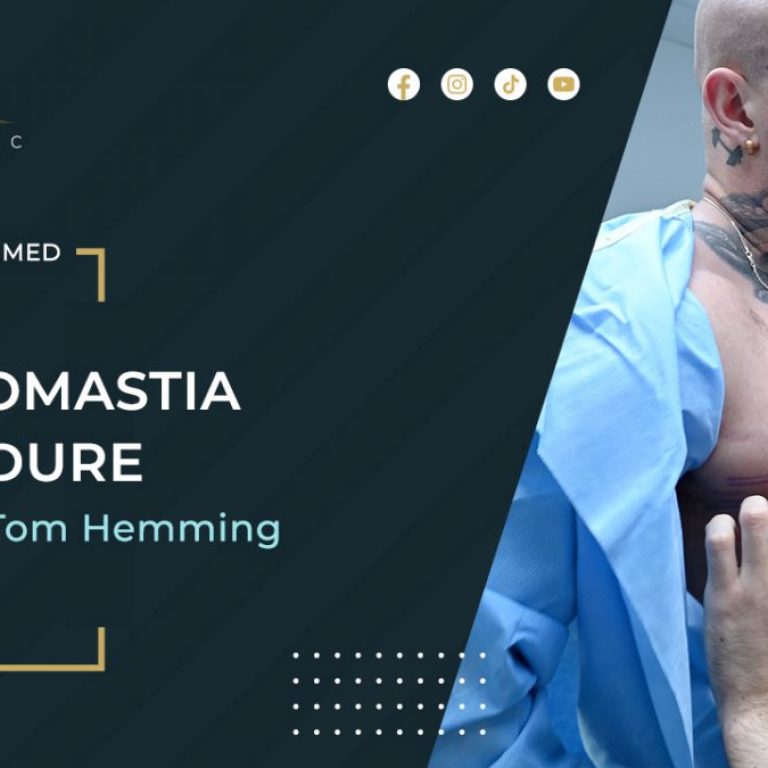 Tom-Hemming-Gynecomastia-1200x675