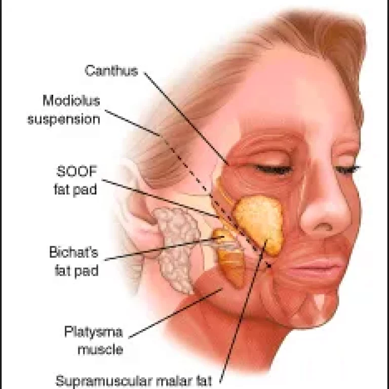 buccal-fat-pad-removal-blog-1