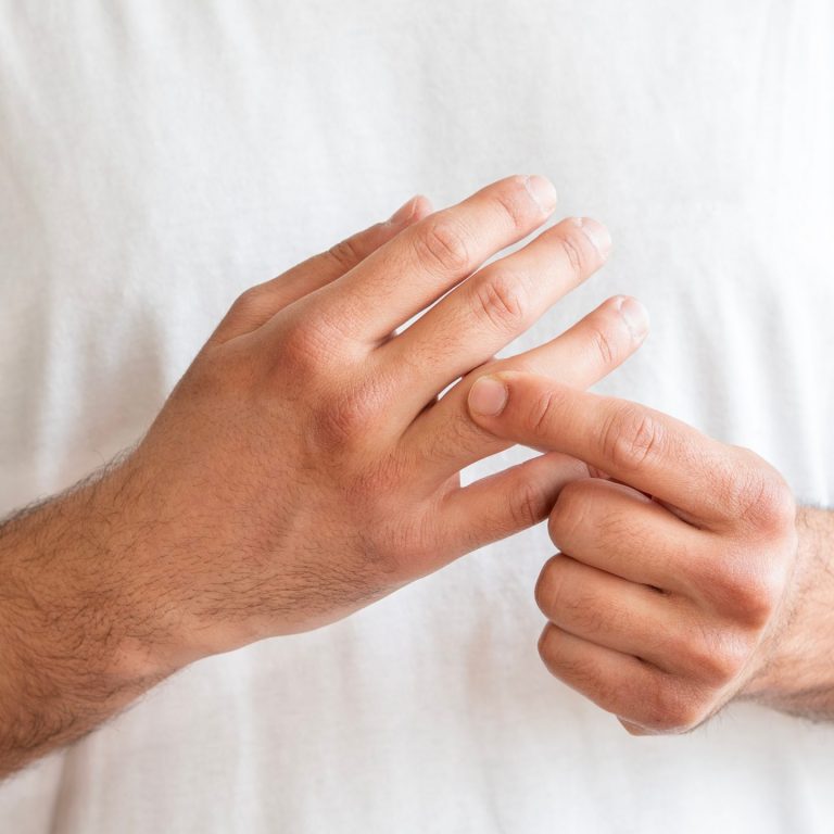 Health,Care,And,Medical,Concept,,Rheumatism,Man,Hand,Pain,From